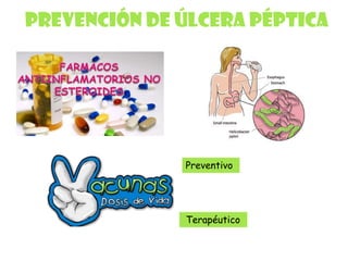 Prevención de úlcera péptica
Preventivo
Terapéutico
 