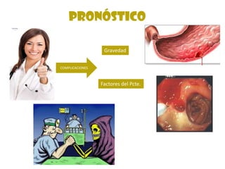 Pronóstico
COMPLICACIONES
Gravedad
Factores del Pcte.
 