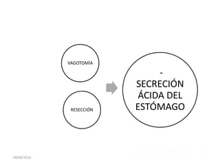 VAGOTOMÍA
RESECCIÓN
-
SECRECIÓN
ÁCIDA DEL
ESTÓMAGO
09/06/2014
 