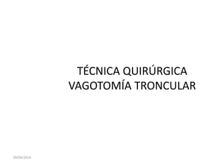 TÉCNICA QUIRÚRGICA
VAGOTOMÍA TRONCULAR
09/06/2014
 