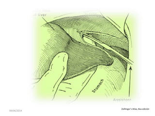 09/06/2014
Zolllinger’s Atlas, 8va edición
 