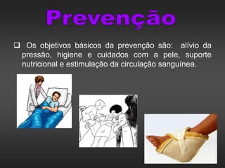  Os objetivos básicos da prevenção são: alívio da
pressão, higiene e cuidados com a pele, suporte
nutricional e estimulação da circulação sanguínea.
 
