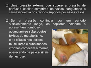  Uma pressão externa que supere a pressão de
perfusão capilar comprime os vasos sangüíneos e
causa isquemia nos tecidos supridos por esses vasos.
 Se a pressão continuar por um período
suficientemente longo, os capilares colabam e
apresentam trombose,
acumulam-se subprodutos
tóxicos do metabolismo,
e as células nos tecidos
musculares e subcutâneos
vizinhos começam a morrer,
aparecendo na pele a sinais
de necrose.
 