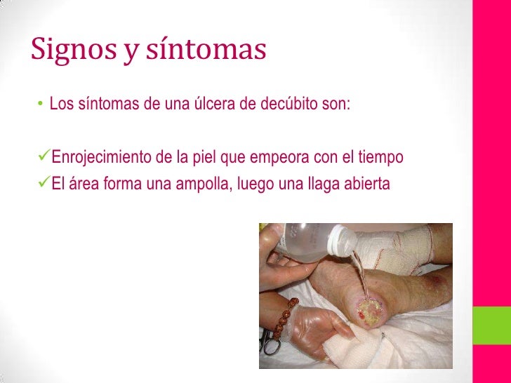 Qué son Causas de la hipertensión ?