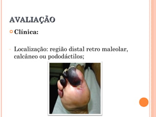 AVALIAÇÃO
 Clínica:



-   Localização: região distal retro maleolar,
    calcâneo ou pododáctilos;
 