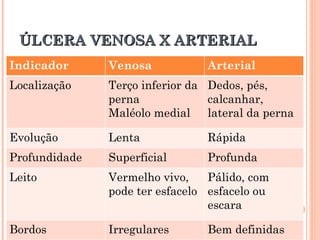 ÚLCERA VENOSA X ARTERIAL
Indicador      Venosa            Arterial
Localização    Terço inferior da Dedos, pés,
               perna             calcanhar,
               Maléolo medial    lateral da perna

Evolução       Lenta             Rápida
Profundidade   Superficial       Profunda
Leito          Vermelho vivo,    Pálido, com
               pode ter esfacelo esfacelo ou
                                 escara

Bordos         Irregulares       Bem definidas
 