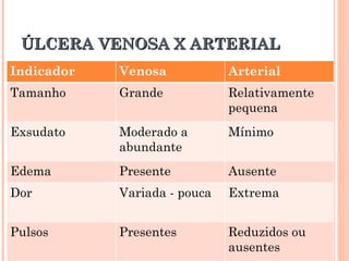 ÚLCERA VENOSA X ARTERIAL
Indicador   Venosa            Arterial
Tamanho     Grande            Relativamente
                              pequena
Exsudato    Moderado a        Mínimo
            abundante
Edema       Presente          Ausente
Dor         Variada - pouca   Extrema


Pulsos      Presentes         Reduzidos ou
                              ausentes
 