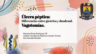 Úlcera péptica:
Diferencias entre gástrica y duodenal.
Vagotomías.
Ramses Rivas Rodríguez 7B
UAdeC Facultad de Medicina Unidad Torreón
Dra Graciela Morales
 
