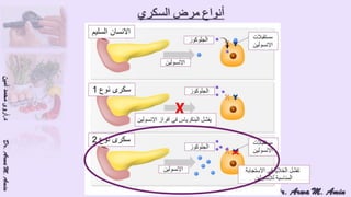 (ضبط أدوية السكر على النظام الغذائي منخفض الكربوهيدرات (نظام اللوكارب