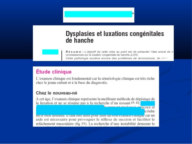 Diagnostic Echographique Precoce De La Luxation Congenitale De La Han