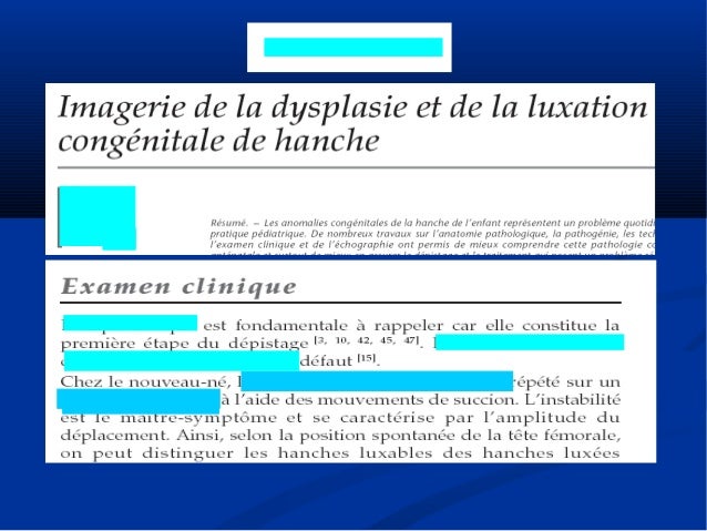 Diagnostic Echographique Precoce De La Luxation Congenitale De La Han