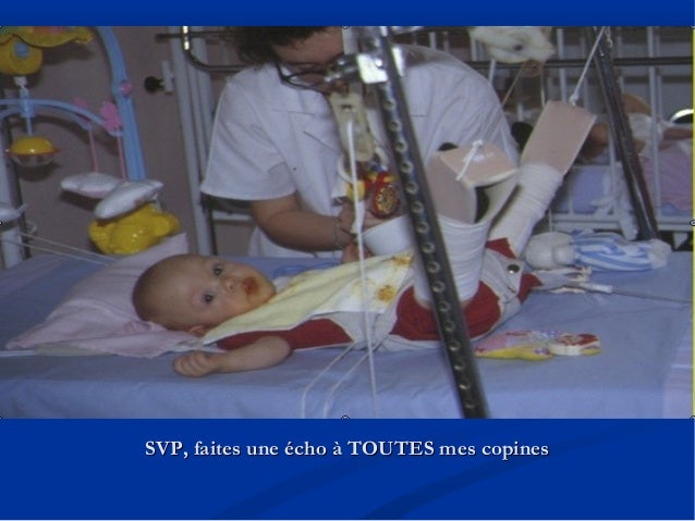 Diagnostic Echographique Precoce De La Luxation Congenitale De La Han