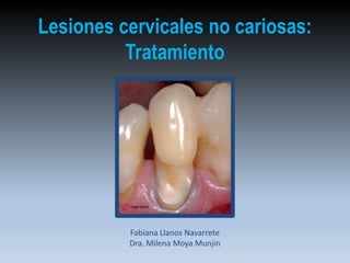 Lesiones cervicales no cariosas:
Tratamiento
Fabiana Llanos Navarrete
Dra. Milena Moya Munjin
 