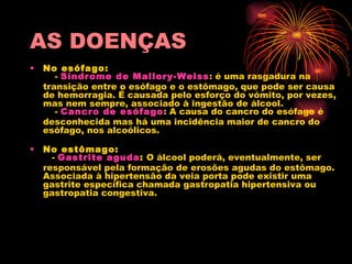 AS DOENÇAS No esófago:     -  Síndrome  de  Mallory - Weiss : é uma rasgadura na transição entre o esófago e o estômago, que pode ser causa de hemorragia. É causada pelo esforço do vómito, por vezes, mas nem sempre, associado à ingestão de álcool.       -  Cancro de esófago : A causa do cancro do esófago é desconhecida mas há uma incidência maior de cancro do esófago, nos alcoólicos. No estômago:    -  Gastrite aguda :  O álcool poderá, eventualmente, ser responsável pela formação de erosões agudas do estômago. Associada à hipertensão da veia porta pode existir uma gastrite específica chamada gastropatia hipertensiva ou gastropatia congestiva. 