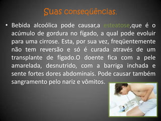 Suas conseqüências.
• Bebida alcoólica pode causar,a esteatose,que é o
  acúmulo de gordura no fígado, a qual pode evoluir
  para uma cirrose. Esta, por sua vez, freqüentemente
  não tem reversão e só é curada através de um
  transplante de fígado.O doente fica com a pele
  amarelada, desnutrido, com a barriga inchada e
  sente fortes dores abdominais. Pode causar também
  sangramento pelo nariz e vômitos.
 