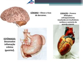 CÉREBRO – Eleva o risco
de derrames.
CORAÇÃO – Provoca
dilatação e
enfraquecimento
resultando em insuficiência
cardíaca e aumento da
pressão arterial.
ESTÔMAGO-
Desenvolve
inflamação
crônica
(gastrite).
 
