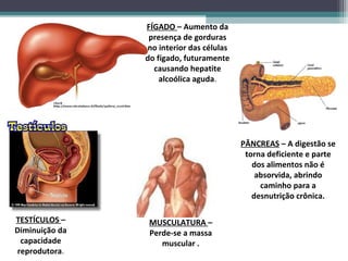 FÍGADO – Aumento da
presença de gorduras
no interior das células
do fígado, futuramente
causando hepatite
alcoólica aguda.
PÂNCREAS – A digestão se
torna deficiente e parte
dos alimentos não é
absorvida, abrindo
caminho para a
desnutrição crônica.
TESTÍCULOS –
Diminuição da
capacidade
reprodutora.
MUSCULATURA –
Perde-se a massa
muscular .
 