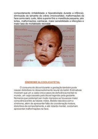 comportamento (irritabilidade e hiperatividade durante a infância),
diminuição do tamanho do crânio (microcefalia), malformações da
face como nariz curto, lábio superiorfino e mandíbula pequena, pés
tortos, malformações cardíacas, maior sensibilidade a infecções e
maior taxa de mortalidade neonatal.
SÍNDROME ALCOOLICAFETAL
O consumo do álcooldurante a gestação também pode
causar distúrbios no desenvolvimento neural do bebê.Estimativas
mostram que um a cada cinco casos de deficiênciamental no
mundo, um seja causado pelo álcoolingerido pela gestante.
Números que poderiam ser muito menores se houvesse maior
consciênciaentre as futuras mães.Bebês nascidos com a
síndrome,além de apresentar falta de coordenação motora,
distúrbios de comportamento,e até retardo mental, costumam
apresentar malformações na face.
 