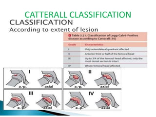 CATTERALL CLASSIFICATION
 