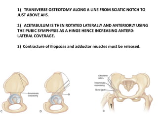 1) TRANSVERSE OSTEOTOMY ALONG A LINE FROM SCIATIC NOTCH TO
JUST ABOVE AIIS.
2) ACETABULUM IS THEN ROTATED LATERALLY AND ANTERIORLY USING
THE PUBIC SYMPHYSIS AS A HINGE HENCE INCREASING ANTER0-
LATERAL COVERAGE.
3) Contracture of iliopsoas and adductor muscles must be released.
 