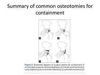 Summary of common osteotomies for
containment
 