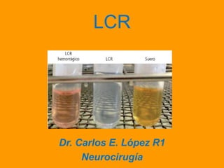 LCR
Dr. Carlos E. López R1
Neurocirugía
 