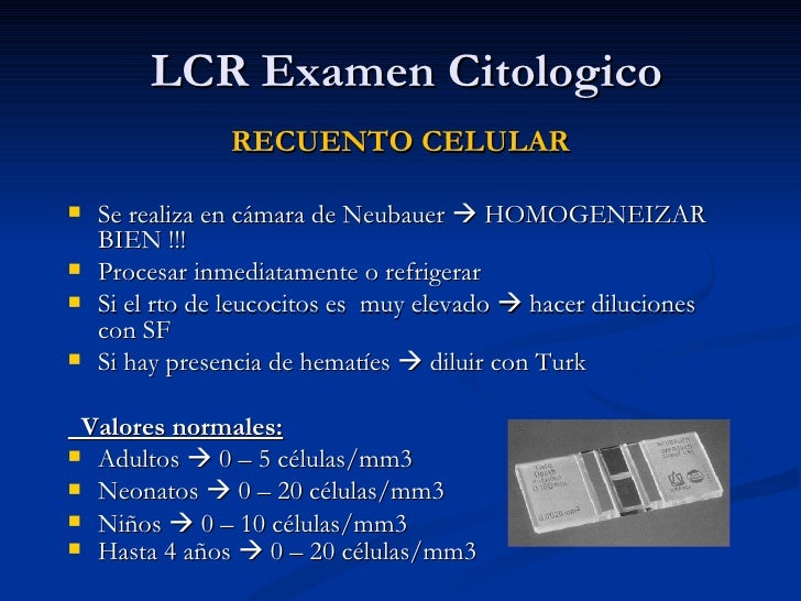 Resultado de imagen para liquido cefalorraquideo examen
