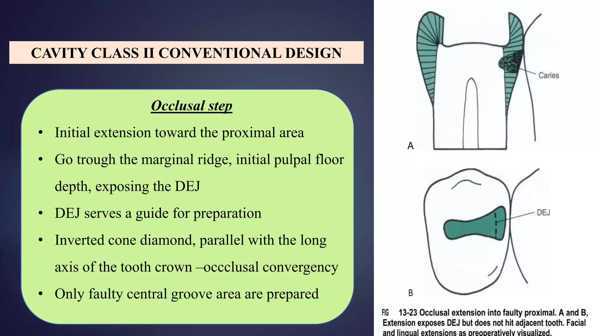 Occlusal step
• Initial extension toward the proximal area
• Go trough the marginal ridge, initial pulpal floor
depth, exposing the DEJ
• DEJ serves a guide for preparation
• Inverted cone diamond, parallel with the long
axis of the tooth crown –occclusal convergency
• Only faulty central groove area are prepared
CAVITY CLASS II CONVENTIONAL DESIGN
 