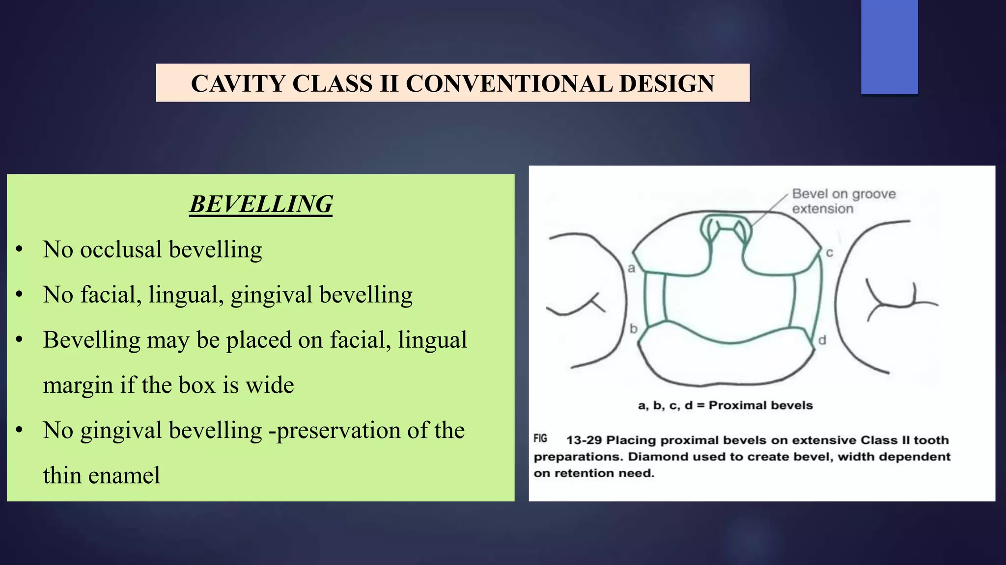 BEVELLING
• No occlusal bevelling
• No facial, lingual, gingival bevelling
• Bevelling may be placed on facial, lingual
margin if the box is wide
• No gingival bevelling -preservation of the
thin enamel
CAVITY CLASS II CONVENTIONAL DESIGN
 