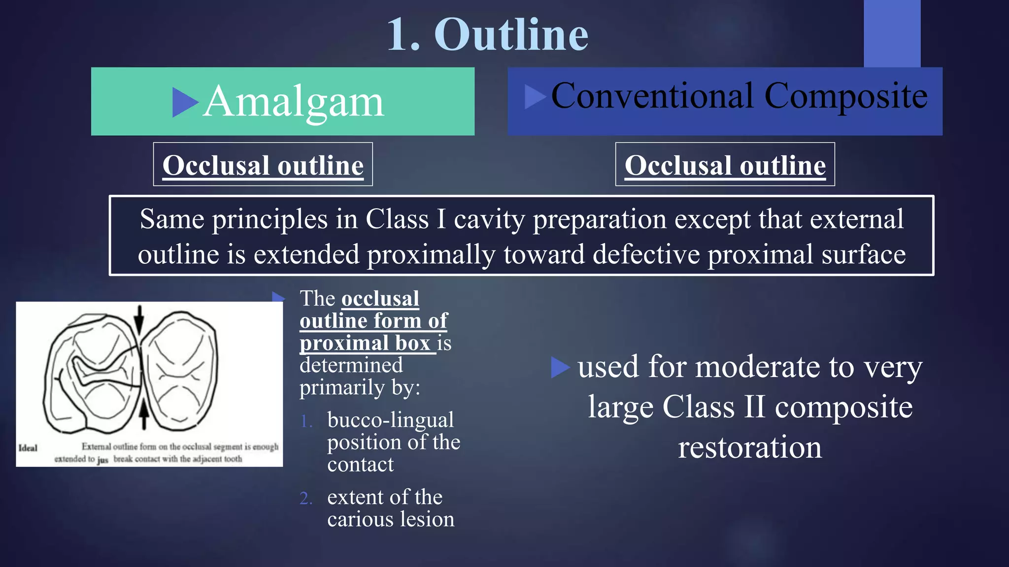 1. Outline
Amalgam
 The occlusal
outline form of
proximal box is
determined
primarily by:
1. bucco-lingual
position of the
contact
2. extent of the
carious lesion
Conventional Composite
 used for moderate to very
large Class II composite
restoration
Occlusal outline Occlusal outline
Same principles in Class I cavity preparation except that external
outline is extended proximally toward defective proximal surface
 