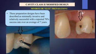 Class I , II Composites Cavity preparations | PPTX