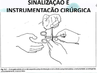 SINALIZAÇÃO E
INSTRUMENTAÇÃO CIRÚRGICA
 Na solicitação destas pinças junto com outro instrumento, o
cirurgião fará o gesto duplo, requisitando a pinça com a mão
esquerda. Nesta eventualidade o instrumentador faz a entrega
simultânea do instrumental pedido, cruzando suas mãos.
 