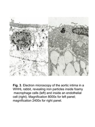 Fig. 3. Electron microscopy of the aortic intima in a
WHHL rabbit, revealing iron particles inside foamy
macrophage cells (left) and inside an endothelial
cell (right). Magnification 8000x for left panel;
magnification 2400x for right panel.
 