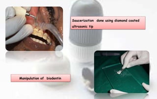LABIOCERVICAL VERTICAL GROOVE | PPTX