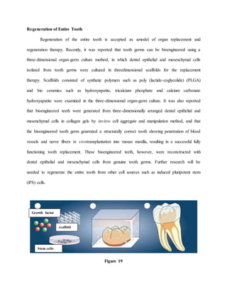 Regenerative endodontics / endodontics courses