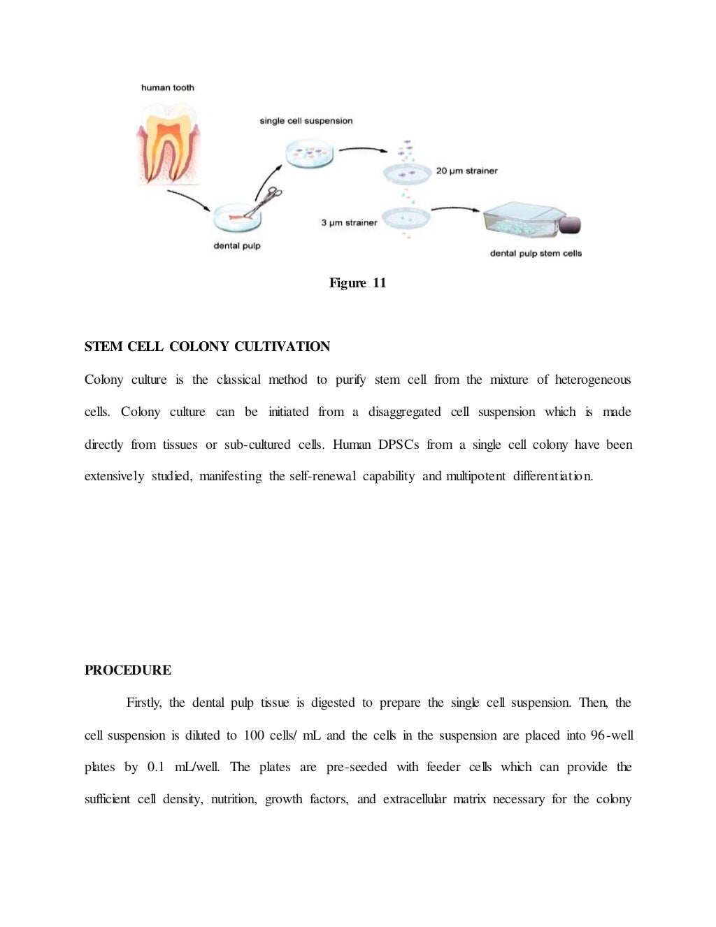 Regenerative endodontics / endodontics courses