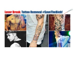 Laser Break: Tattoo Removal #SaveTheBieb!
 