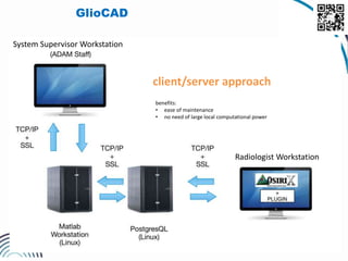 12
client/server approach
System Supervisor Workstation
Radiologist Workstation
benefits:
• ease of maintenance
• no need of large local computational power
GlioCAD
 