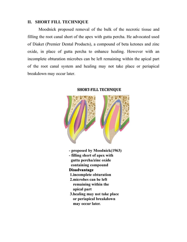 management of non vital open apex roots/ orthodontic course by indian dental academy