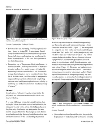 ldushane,+JPOSNA+365+NOV+2021+-+Current+Concept+Review+-+FINAL (1).pdf