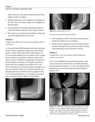 ldushane,+JPOSNA+365+NOV+2021+-+Current+Concept+Review+-+FINAL (1).pdf