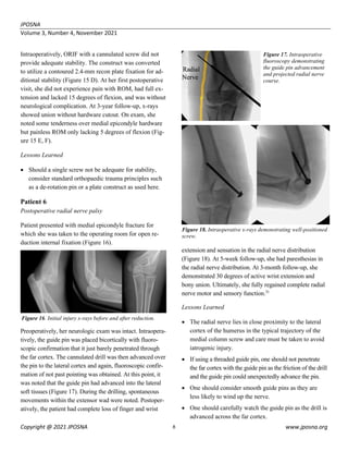 ldushane,+JPOSNA+365+NOV+2021+-+Current+Concept+Review+-+FINAL (1).pdf