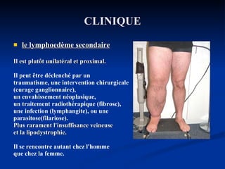 CLINIQUE le lymphoedème secondaire   Il est plutôt unilatéral et proximal.  Il peut être déclenché par un  traumatisme, une intervention chirurgicale (curage ganglionnaire), un envahissement néoplasique,  un traitement radiothérapique (fibrose), une infection (lymphangite), ou une  parasitose(filariose). Plus rarament l'insuffisance veineuse et la lipodystrophie.  Il se rencontre autant chez l'homme  que chez la femme.   