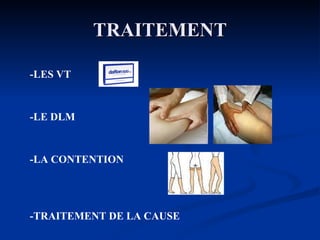 TRAITEMENT -LES VT -LE DLM -LA CONTENTION -TRAITEMENT DE LA CAUSE 