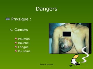 Dangers Physique : Cancers Poumon Bouche Langue Du seins 