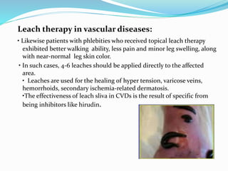 Leach therapy in vascular diseases:
• Likewise patients with phlebities who received topical leach therapy
exhibited better walking ability, less pain and minor leg swelling, along
with near-normal leg skin color.
• In such cases, 4-6 leaches should be applied directly to the affected
area.
• Leaches are used for the healing of hyper tension, varicose veins,
hemorrhoids, secondary ischemia-related dermatosis.
•The effectiveness of leach sliva in CVDs is the result of specific from
being inhibitors like hirudin.
 