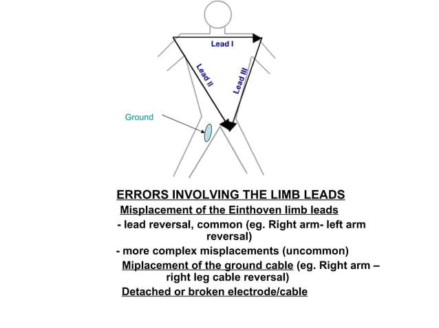 Lead errors introduction | PPT