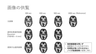 画像の供覧
1800 sec (Reference)
900 sec
600 sec
300 sec
元画像
提案手法適用画像
通常処理適用画像
Gaussian
(FWHM = 4 mm)
• 放射線画像を用いず
超解像モデルを作成できた
• 汎用性が高くボケの少ない
ノイズ低減処理が提案し得た
 