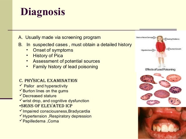 Lead Poisoning In Pediatrics Dr Trynaadh