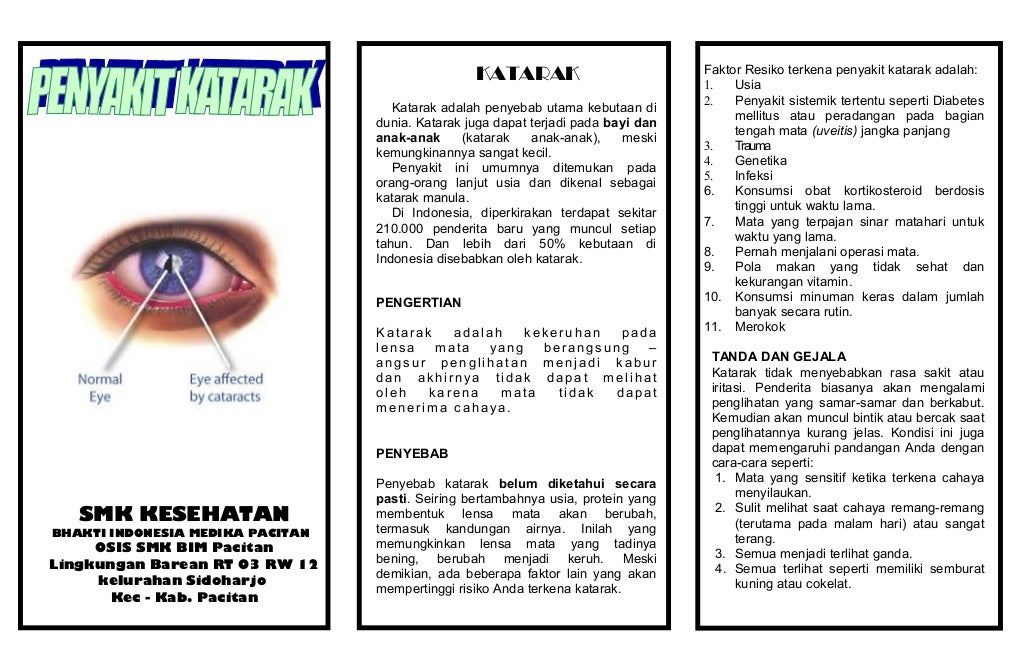 Leaflet katarak